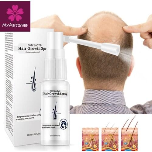 OMY LADY Anti Hair Loss Hair Growth Spray Essential Oil Liquid For Men Women Dry Hair Regeneration Repair Hair Loss Products