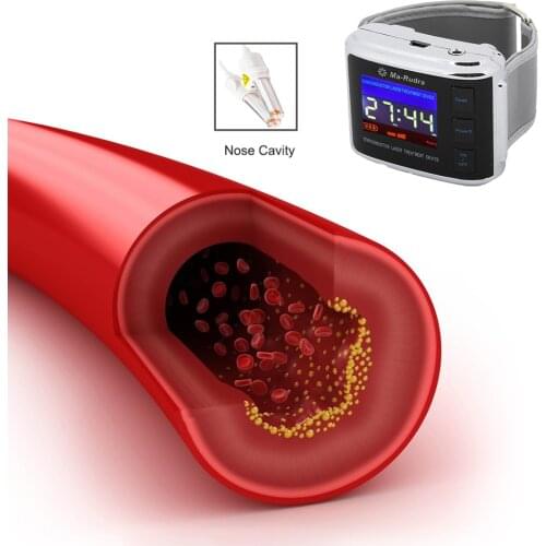 Physiotherapy Diabetic Wrist Laser Therapy Rhinitis Diabetes Cholesterol Hypertension Laser Physiotherapy Wrist Watch