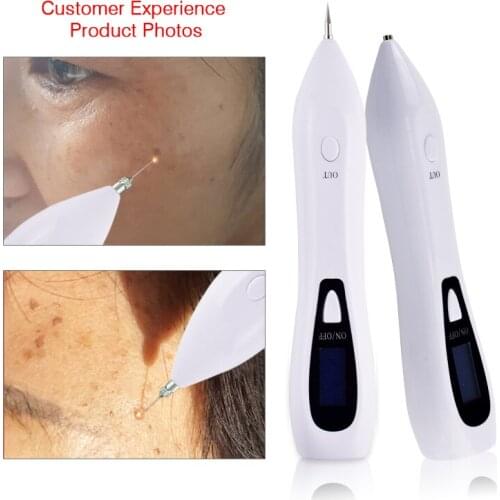 New LCD Laser Tattoo Removal Machine Face Freckles Mole Wart Removal Skin Care Point Pen Beauty Care Tool With 55 Fine Needles