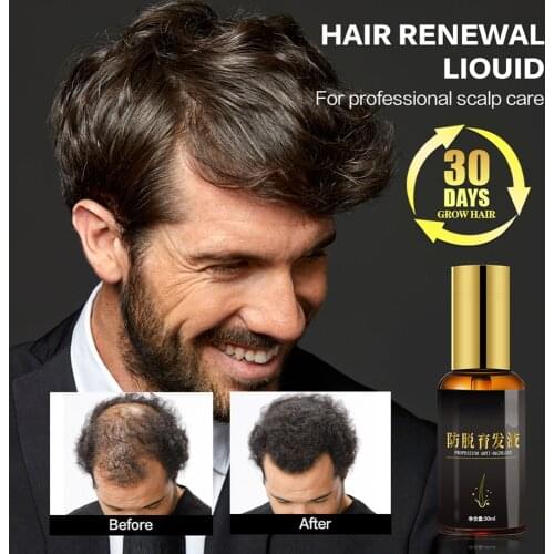 Anti Hair Loss Treatment Hair Growth Essence Oil for Fast Hair Growth Hair Care Product Nourishing Hair Root Solution Hair Tonic