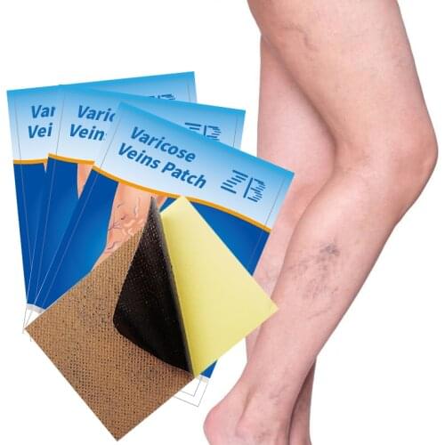 6/12pcs Varicose Veins Patches Anti-swelling Angiitis Removal Spider Leg Vasculitis Phlebitis Chinese Medical Plasters