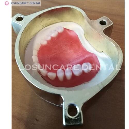 Copper Denture Flask Dental Lab Press Compress Compressor Equipment Parts Flask On Acrylic Partial Work