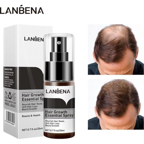 LANBENA Hair Growth Essence Spray Anti Hair Loss Preventing Baldness Consolidating Nourish Roots Promote Hair Growth Hair Care