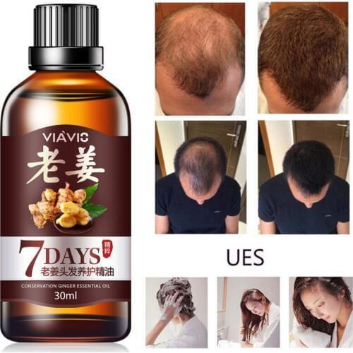 New 30ml Fast Hair Growth Essential Oil Effective Hair Loss Treatment Regrowth Ginger Serum Hair Health Care Beauty TSLM1