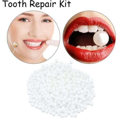 15/25g Temporary Tooth Replacement Material Tooth Filling Temp Replace Missing Denture Adhesive DIY Teeth Repair Dental Beauty