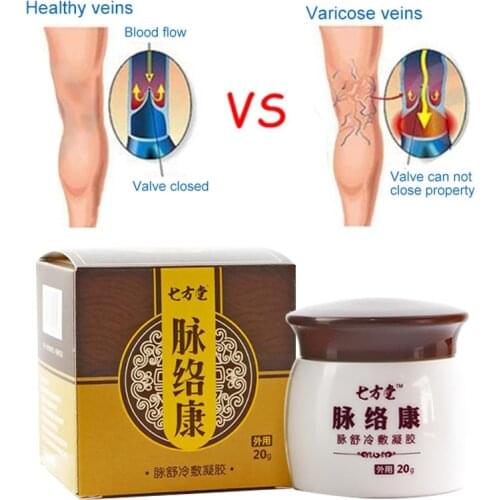 Varicose Vein Treatment Cream Repair Vasculitis Phlebitis Massage Relieve Swelling Nourish Mineral Vegetable Oil Body Care 20g