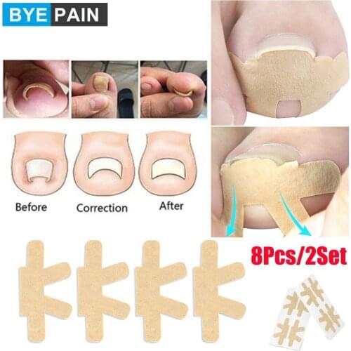 8Pcs/2Set Embedded Toe Nail Corrector Sticker Toenail Care Pedicure Thumb Curl Correction Sticker Paronychia Recover