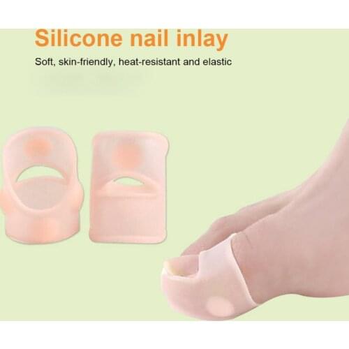 Nail Inlay Appliance Nail Groove Prevent Nail Growing Ingrown Nail Appliance Orthosis Painless Correction Relief Foot Care Tool