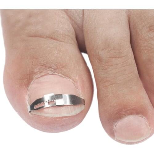 Ingrown Toe Nail Correction Tool Toenail Straightening Correctors Patch Tool Straightening Clip Brace Pedicure Tool