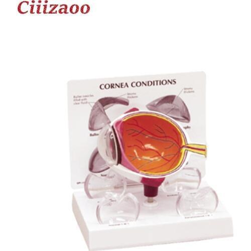 Medical Education human pvc eye cornea conditions Eye Model Anatomy Model