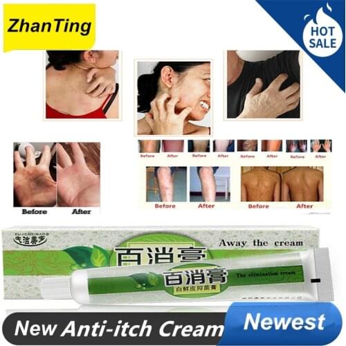 ZhanTing 3 Pcs Ltchy Skin Cream Mosquito Bites Eczema Ointment Treatment Ltchy Skin Cream Care Cream