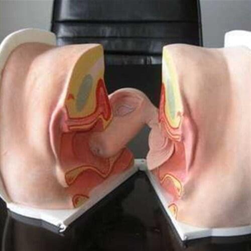 BIX-F5L Advanced Female IUD Training Model Australia Freight Free, AU Freight Free WBW285