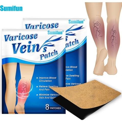 8Pcs Varicose Veins Patch Phlebitis Vasculitis Treat Sticker Thigh Spider Removal Pain Relief Plaster Remove Vascular Blockage