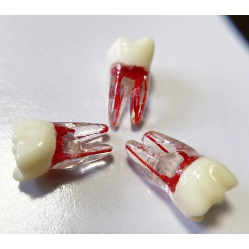 36# Teeth Model Dental Endo Files Practise Tooth Tool 2-Rooted Canal Red Pulp Upper Molar