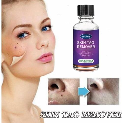 Skin Tag Remover 10/20/30g Painless Skin Tag Removal Solution Mole Skin Dark Spot Removal Face Wart Tag Removal TSLM2