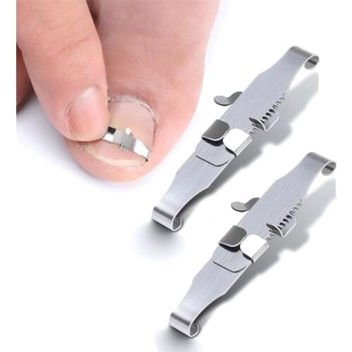 2Pcs Ingrown Toe Nail Correction Tool Toenail Straightening Correctors Patch Tool Kit Nail Repair Orthosis Foot Care Tool