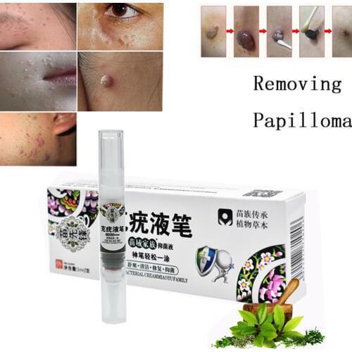 Genital Wart Treatment Papillomas Removal Of Warts Liquid From Skin Band-Aid Removing Against Moles Remover Anti Verruca Remedy
