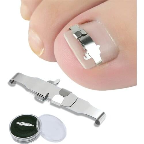 Ingrown toenail corrector Tools Pedicure Recover Embed Toe Nail Treatment professional Ingrown toenail correction Foot Care Tool
