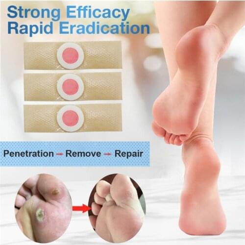 12/24/60pcs Foot Care Medical Plaster Feet Medical Corn Remover Warts Thorn Patch Callus Removal Sticker Soften Skin Cutin