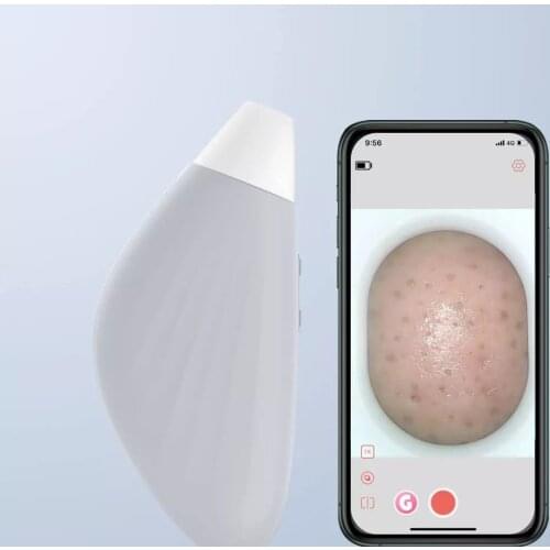 Techlove Skin Care Devices