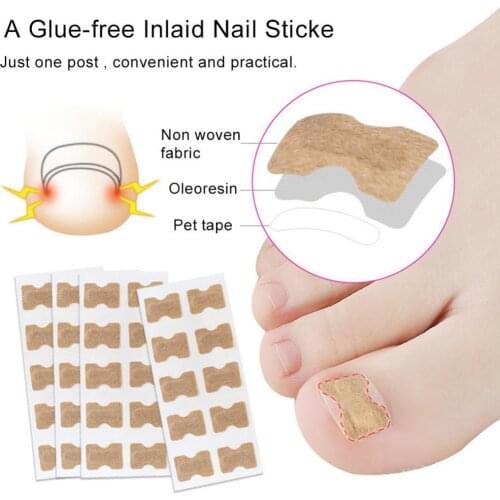 50% Hot Sale 50Pcs Ingrown Toe Nail Correction Sticker Paronychia Foot Pedicure Corrector