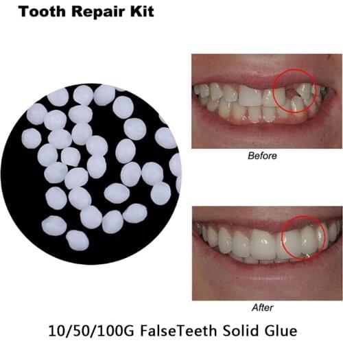 5g/10g/50g/100g Resin FalseTeeth Solid Glue Temporary Tooth Repair Set Teeth And Gap Falseteeth Denture Adhesive Teeth Dentist