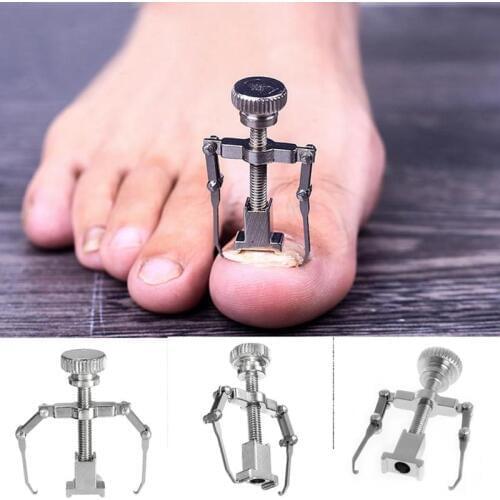 Ingrown Toenails Correction Pedicure Foot Toe Nail Care Tools Straightening Clip Brace Corrector Ingrown Toe Nail Fixer