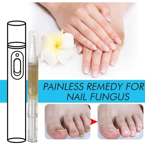Fungus Treatment Pen Set Nail Fungus Cream Toenail and Nail Repair Pen Toenail And Nail Care Solutions SANA889