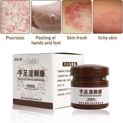20g Psoriasis Cream Relief Hand Foot Eczema Pruritus Dermatitis Wet Ringworm Medical Plaster Skin Pain Care Herbal Ointment