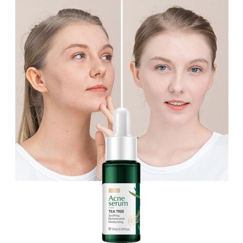 SZYDIT Whitening Face Serum