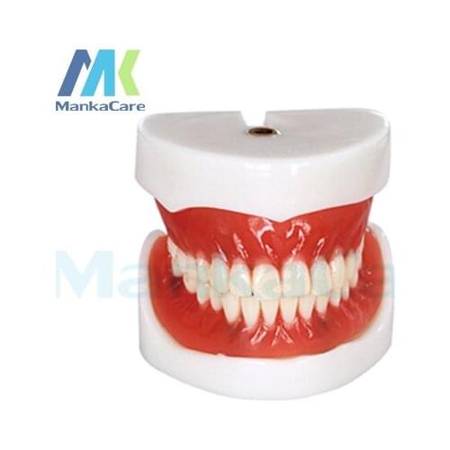 Manka Care - Full Denture Implant Mode Oral Model Teeth Tooth Model