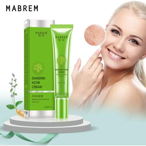 Herbal plant extract repair cream remove acne marks repair rough pores deep cleansing facial horny facial skin care cream 20g