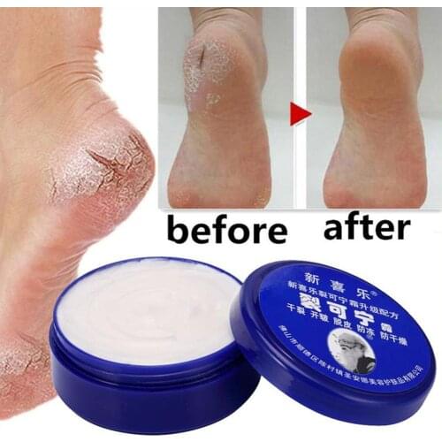 Original Anti frostbite Hand Cream Anti-Drying Heel Cracked Repair Cream Removal Dead Skin Foot Cream Hand Feet Care