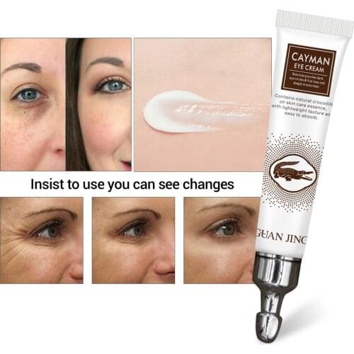 Eye Cream Anti Aging Wrinkle Remover Dark Circles Fat Granules Moisturizing Eye Care Against Puffiness Bags for Face Eye Serum