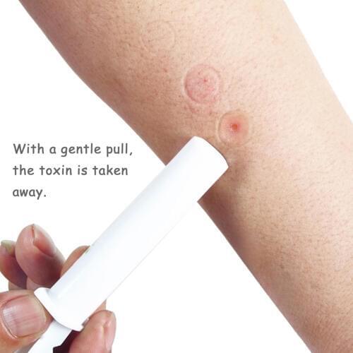 1PC Vacuum mosquito bite outdoor pipette Extractor Pump Kit Will Suction Out Poison/Venom From Snake and Bug Bites Safety