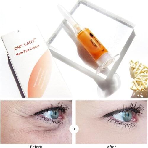 OMYLADY EyeCream Instant Remove Eyebags Firming Eye Anti Puffiness Dark Circles Under Eye Anti Wrinkle Anti Age Eye Care