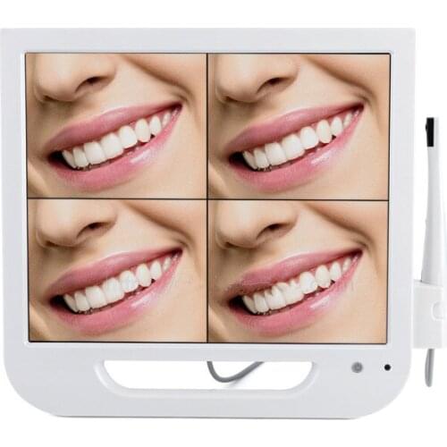 5.0 mega pixels 17inch LCD monitor with usb intra oral camera all in one machine Dental endoscope WiFI
