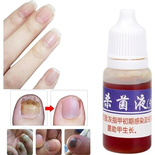New 10ml Onychomycosis Remover Serum Prevent Fungus Infection Paronychia Repair Cleanser Disinfect Nail Treatment Liquid TSLM2