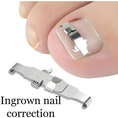 1pair Ingrown Nail Correction Nail Fixer Embed Toenail Tool Pedicure Correction Lifter Recover Care Tool Pedicure Foot X3L1