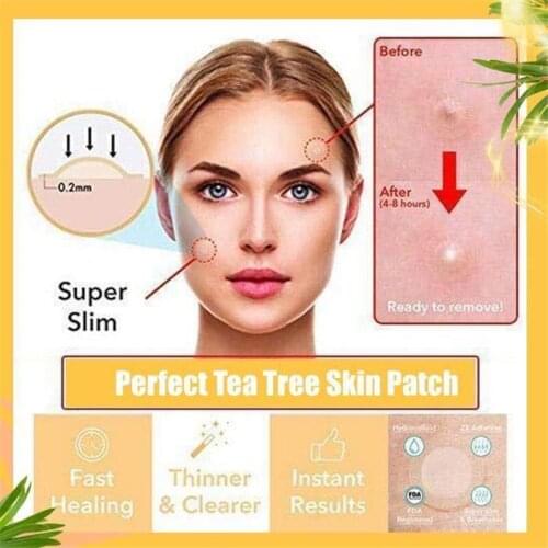 Perfect Tea Tree Skin Tag Patch Ance Pimple Patch Plaster Acne Cream Hydrocolloid Master Anti-infection Quick Absorb Face Care
