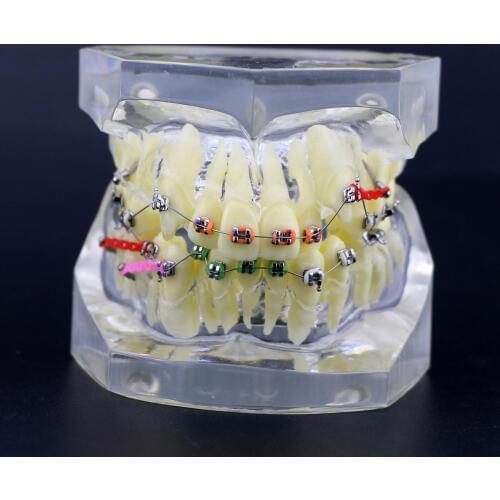 1pc Orthodontic Dental Treatment Malocclusion Model W/ Brackets Chain Wire #3005 03