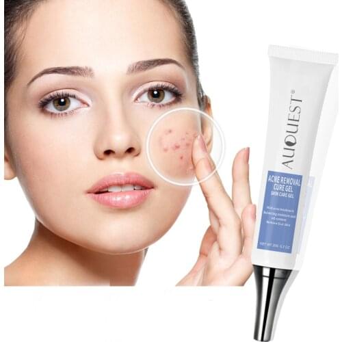 AUQUEST Acne Treatment Face Cream Oil Control Whitening Moisturizing Anti Acne Cream Skin Care 20g