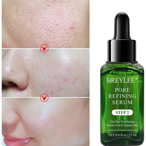 BREYLEE Shrink Pores Serum Pore Tightens Refining Moisturizing Essence Whitening Anti-aging Oil Control Facial Essence Skin Care