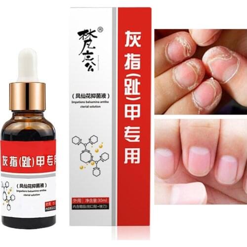 Fungal Nail Treatment Essence Toe Care Repair Serum Hand Foot Nail Fungus Removal Gel Anti Infection Paronychia Onychomycosis