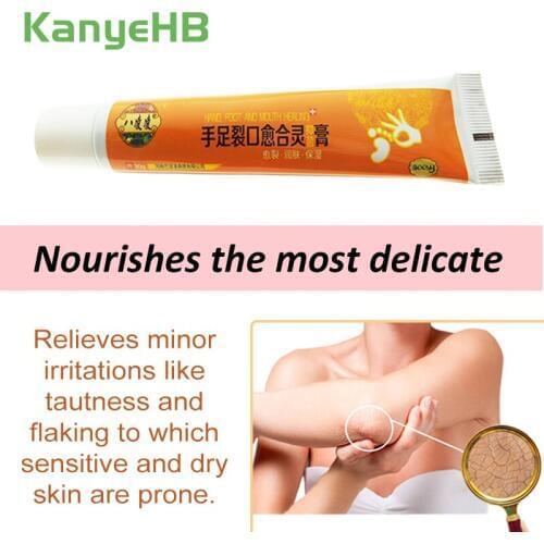 1Pcs Feet Dead Skin Remover Ointment Oil Repair Skin Care Product Anti-Drying Crack Cream Strong Effective Hand Heel Cream S012
