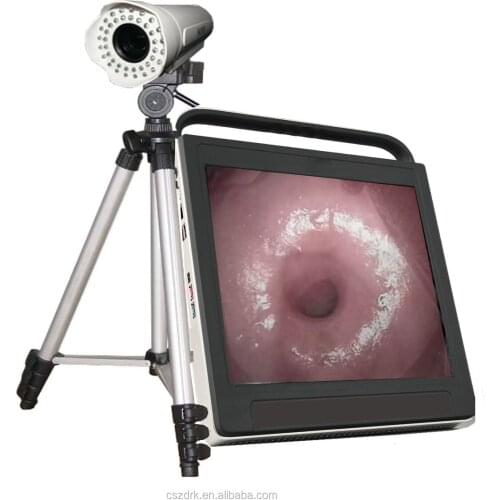 HD digital video colposcope for gynecology colposcopy for vagina