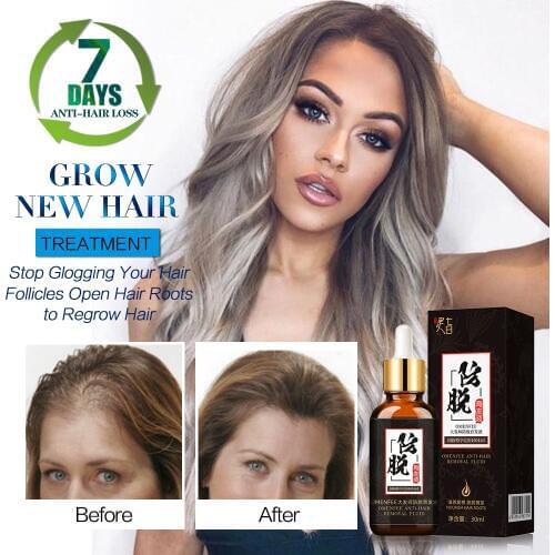 Hair Growth Essence Oil Hair Growth Serum Anti Hair Loss Treatment Solution Hair Care Hair Loss Produrts Hair Tonic