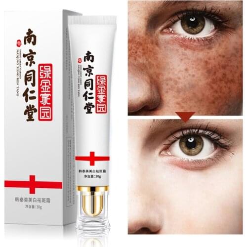 Effective Whitening Freckle Cream Remove Melasma Acne Spot Pigment Melanin Dark Spots Pigmentation Moisturizing Gel Skin Care
