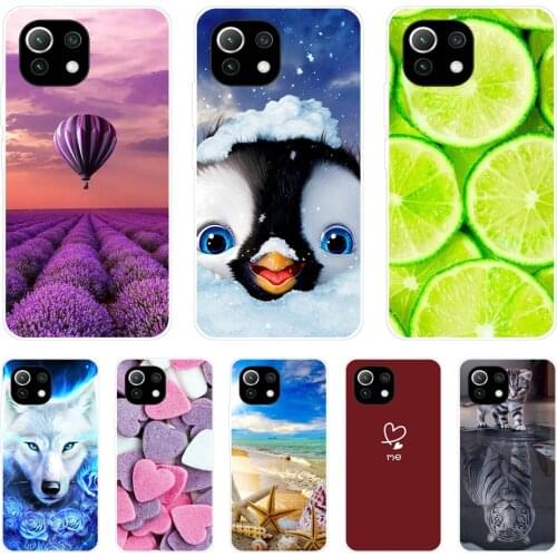 For xiaomi Mi 11 | Mi 11 Lite 5G 4G | Mi 11i Case Back For Xiaomi Mi 11 Ultra Phone Cover Silicon Funda black tpu case