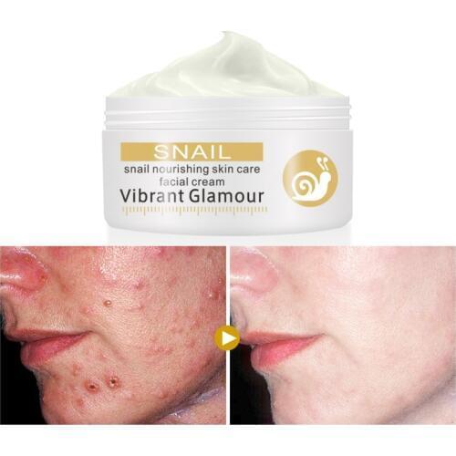 Repairs Snail Face Cream Remove Wrinkles Acnes Cream Whitening Pigment Spots Brighten Skin Wrinkle Control Oil